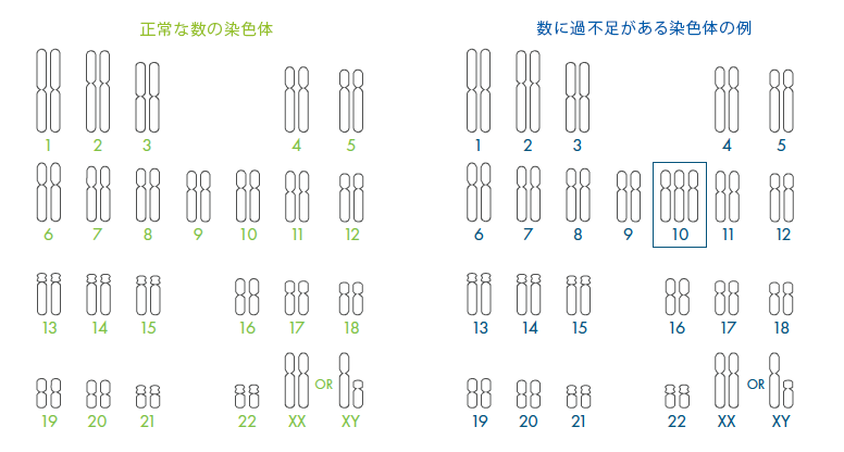 Comparison between normal and an abnormal number of chromosomes.