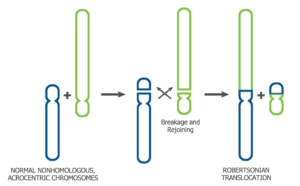 pgd-robertsonian-translocation